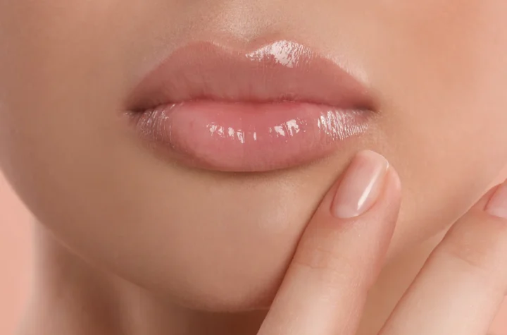 "Pucker Up Perfection: Fotona 4D Lip Augmentation"