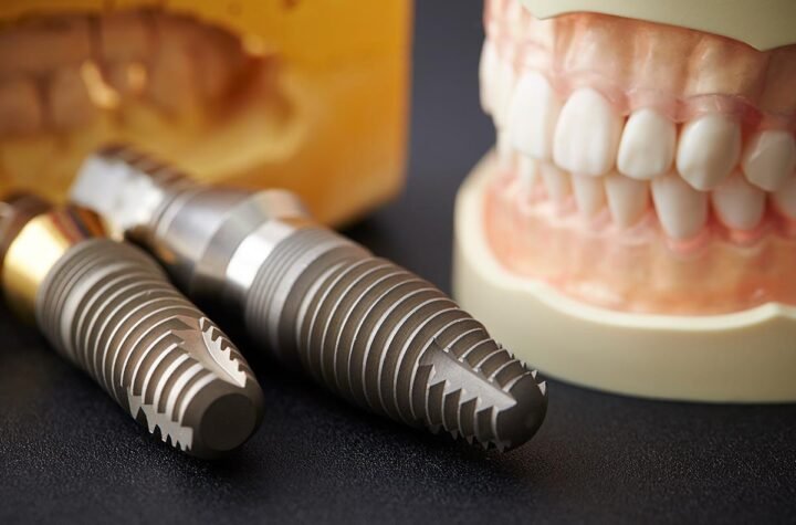 tooth implant