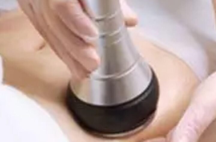 Pain Management During Laser Hair Removal