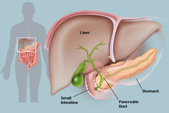 Non-Surgical Solutions for Pancreatic Stones: Effective Alternatives to Surgery