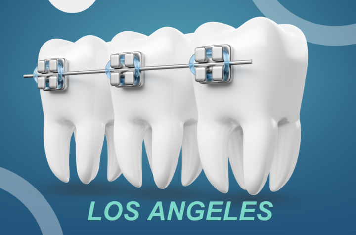 Los Angeles orthodontics