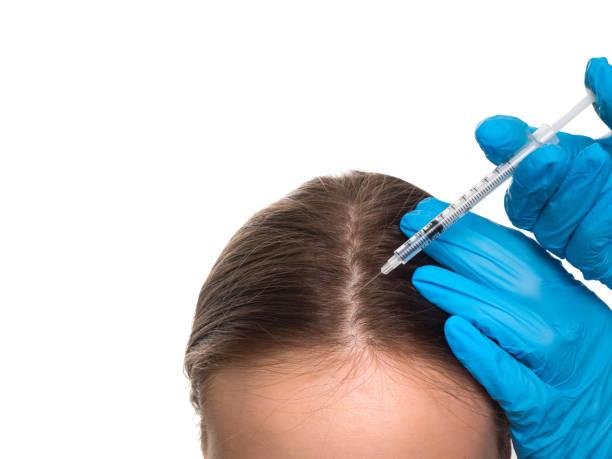 Revitalize Your Hair with PRP Treatment